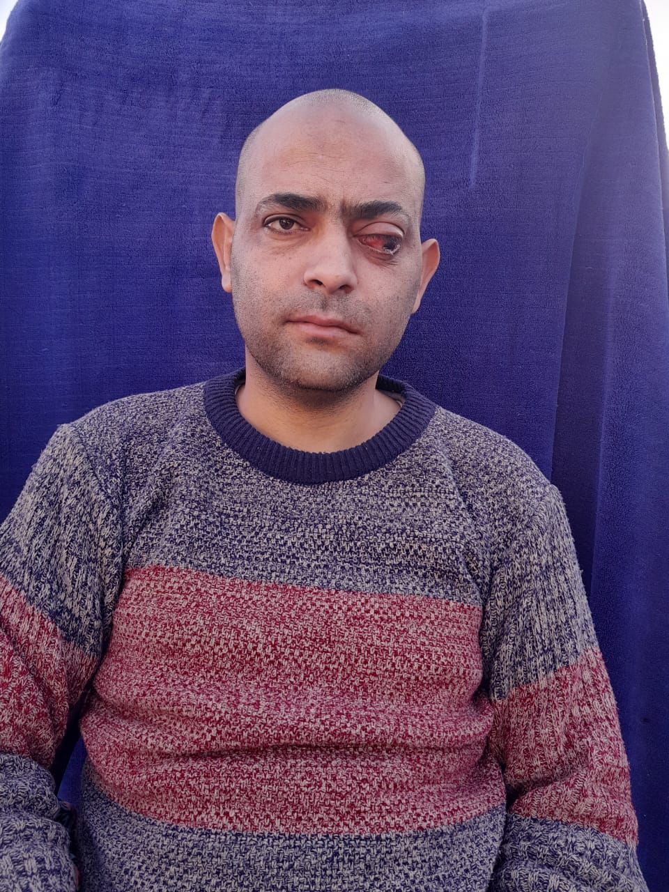 محمد أبو رجيله بعد الإصابة