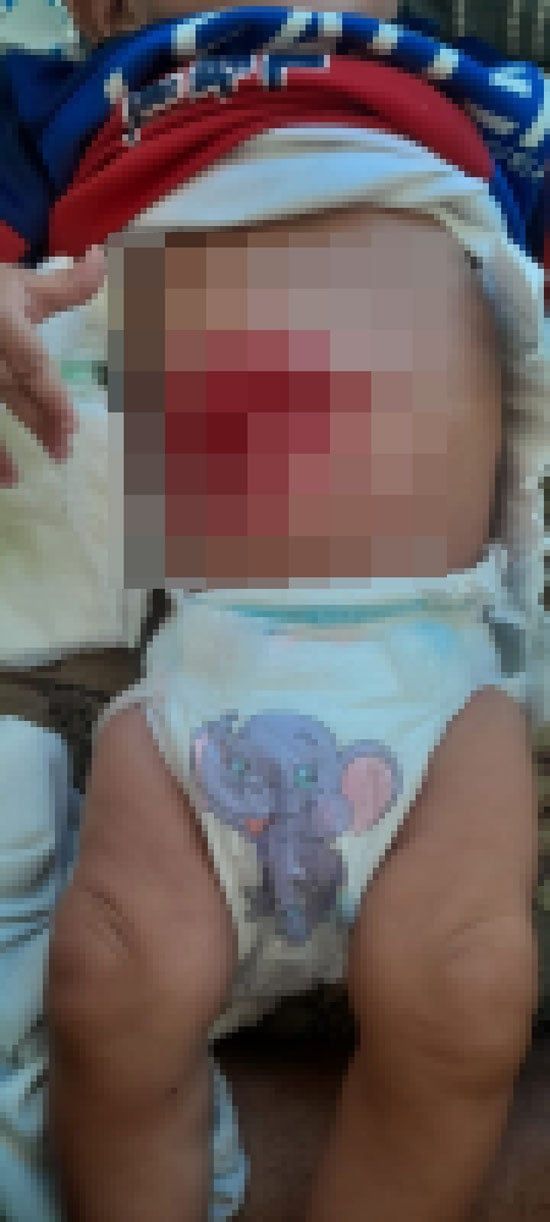 97484-الطفل-عمرو-أبو-يوسف 97484-الطفل-عمرو-أبو-يوسف