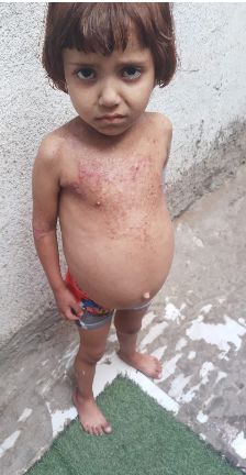 معاناة الطفلة جودي حنون