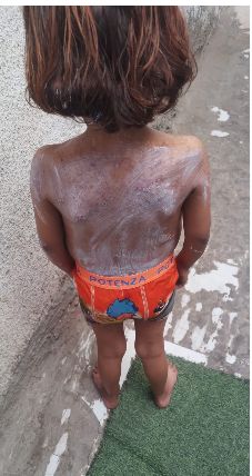 الطفلة جودي حنون