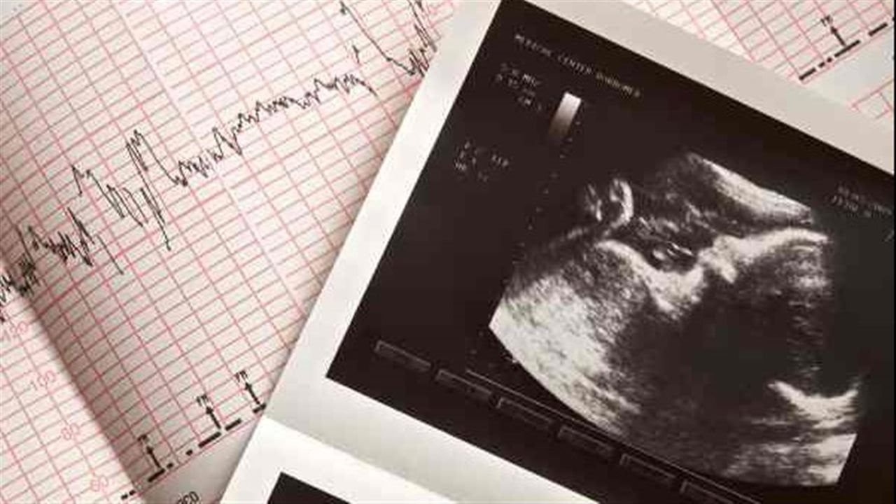 التعرض لمادة كيميائية شائعة أثناء الحمل قد يخلّ بتطور الجنين