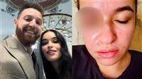 21 فبراير أولى جلسات محاكمة الفنان محمود حجازي بتهمة التعدي على زوجته