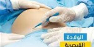 معدلات وفيات الأمهات 25 لكل 100 ألف.. متحدث الصحة يكش أضرار الولادة القيصرية