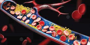 سرّ بسيط لصحة القلب.. أطعمة تخفض الكوليسترول خلال أسابيع
