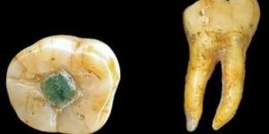 حضارة المايا ابتكرت أول حشوة أسنان فى العالم بالأحجار الكريمة