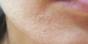 علامات تنذر بتجفاف الجسم