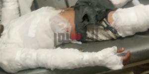 بالأسماء.. إصابة 5 أشخاص في حريق نشب بيخت في مطروح