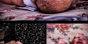 من فقدان شقيقها لمعركة الحياة.. الرضيعة أيسل الهمص تواجه مرضا وراثيا نادرا في غزة