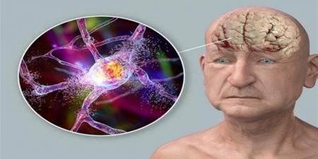 اكتشاف مؤشر بيولوجي لتسارع شيخوخة الدماغ