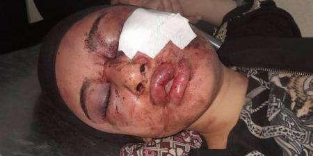 تحقيقات مكثفة لكشف ملابسات إصابة فتاة على يد مجهول بمنزلها في المنوفية