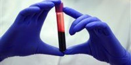 الدم الذهبي.. يحمله 50 شخصا فقط ومحاولات لاستنساخه في المعمل