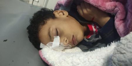 تلميذ يُجري جراحة دقيقة بمستشفى جامعة سوهاج إثر إصابته في العين