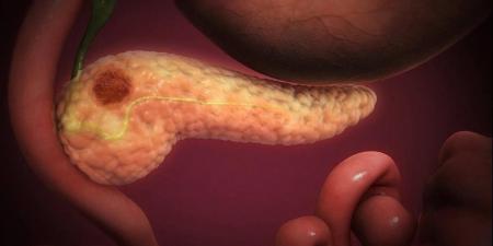 اكتشاف واعد قد يوقف السكري قبل بدايته