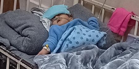 عينان مغمضتان وجسد منهك.. قصة معاناة مسك العديني تختصر وجع أطفال غزة.. صور