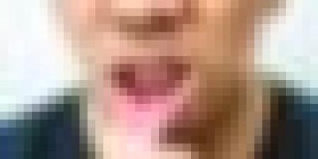 لعلاج تقرحات الفم.. إليك 4 أطعمة مناسبة