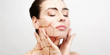 علامات جفاف يجب تجاهلها ونصائح للحفاظ على ترطيب الجسم