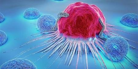 يقلل التكلفة والمعاناة.. الفحص المبكر طوق النجاة من السرطان