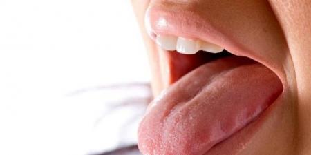 أمراض خطيرة تختبئ وراء جفاف الفم