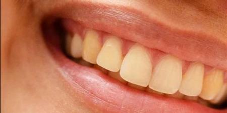 أطعمة مفيدة وأخرى ضارة للأسنان