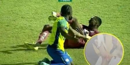 إصابة مأساوية للبرازيلي روماريو دا سيلفا في الدوري الهندوراسي.. فيديو