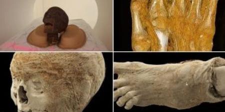 أسرار المومياوات.. كيف تكشف التحاليل الطبية حكايات عاشها القدماء؟
