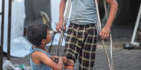 طفل فلسطينى يستعين بـ"ماسورة" لتعويض قدمه المبتورة بسبب القصف الإسرائيلى