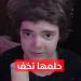 آلام مرضى انحلال الجلد الفقاعي.. "ريفولا" تروي قصة مرضها ومعاناتها (فيديو)
