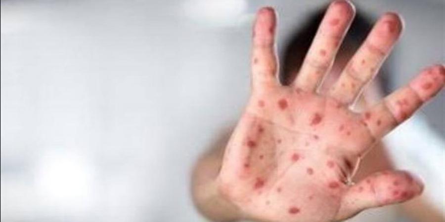 وزارة التعليم تكشف إجراءات حماية طلاب المدارس من فيروس الميتانيمو الجديد