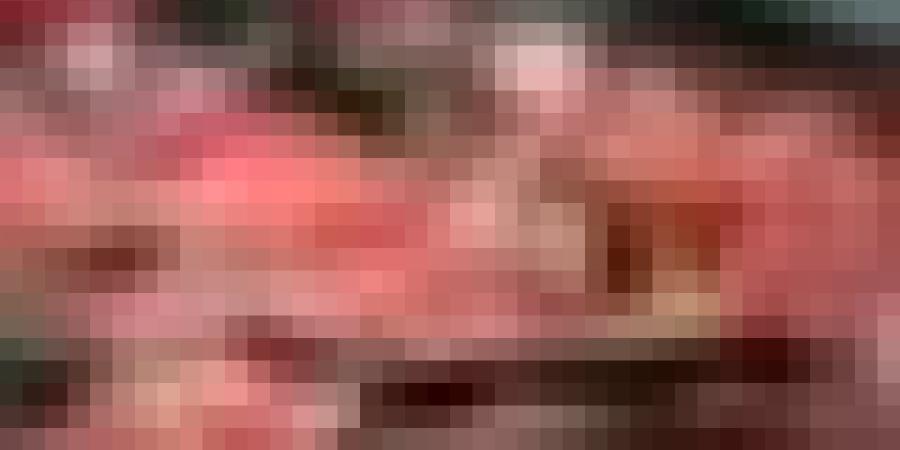 3 عناصر غذائية يمكن أن تزيد خطر الإصابة بالسرطان في صمت