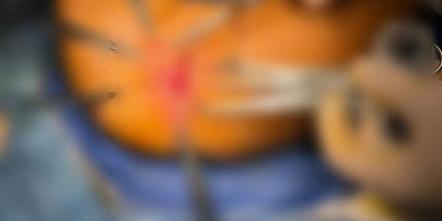 إنجاز طبي بمستشفى مبرة طنطا.. نجاح جراحة دقيقة لإصلاح عيب خلقي نادر لطفلة رضيعة