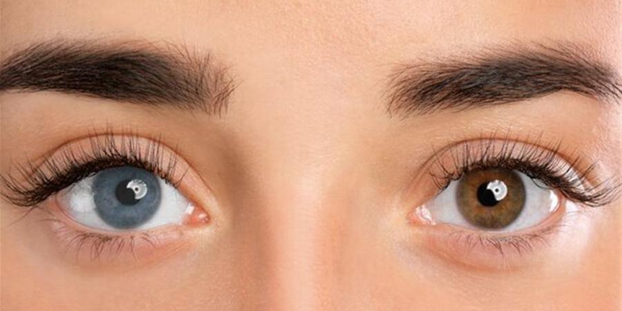 أمراض قد تسبب تغيرات في قزحية العين