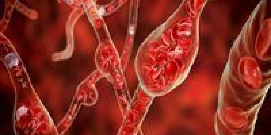 تحذيرات علمية دولية.. عامل بيئي خفي وراء ارتفاع ضغط الدم