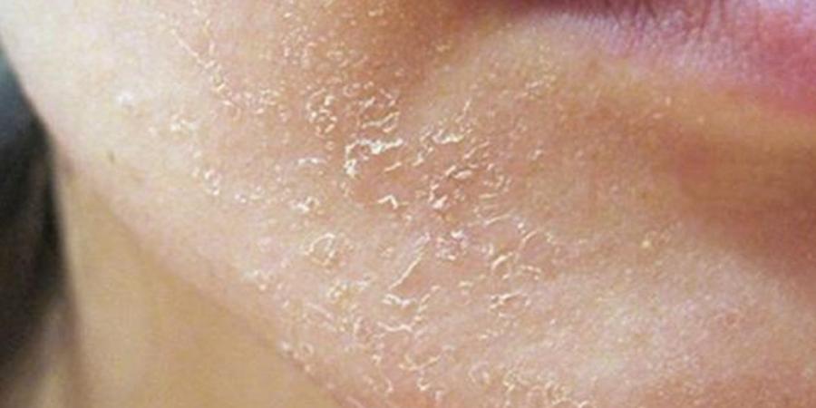 علامات تنذر بتجفاف الجسم