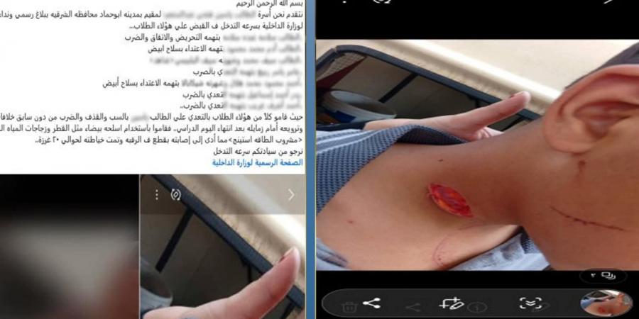 خدوش وجرح قطعي بالرقبة.. 7 طلاب يعتدون على زميلهم بزجاجة فارغة في الشرقية