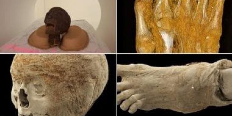 أسرار المومياوات.. كيف تكشف التحاليل الطبية حكايات عاشها القدماء؟