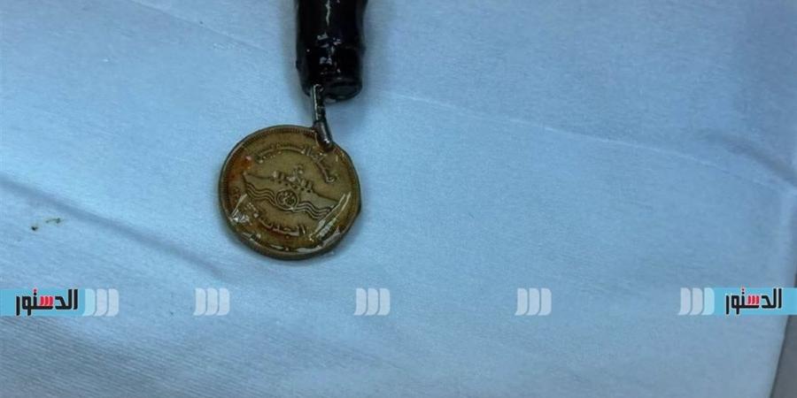 استخراج عملة معدنية من مريء طفل خلال 5 دقائق في كفر الشيخ
