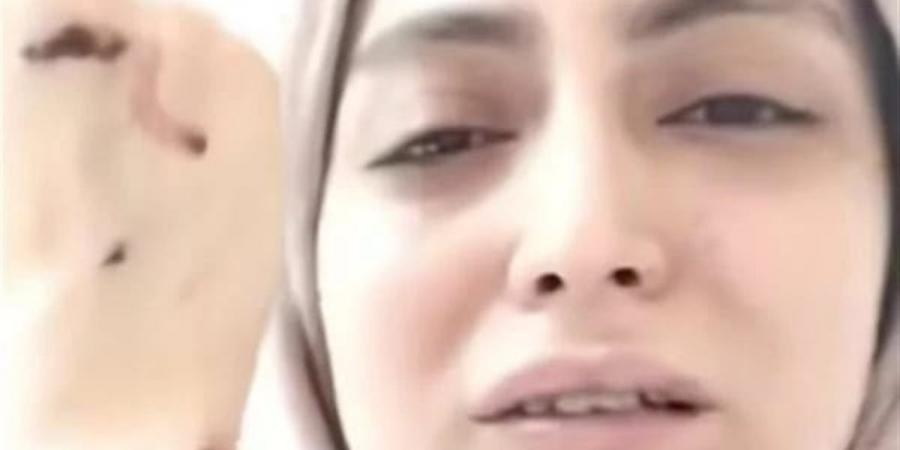 إخلاء سبيل الأب ونجلتيه فى واقعة التعدى على طبيبة الأسنان بشبرا الخيمة