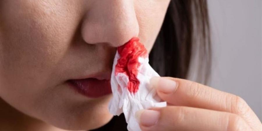 7 عادات بسيطة تقلل خطر نزيف الأنف في الصيف